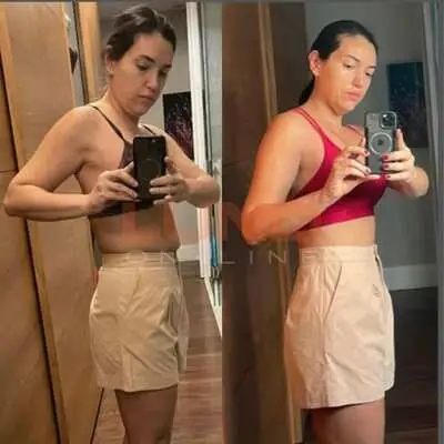Antes e depois de aluna da Lund Online, resultado 4